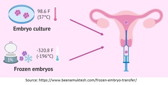 Embryo Freezing