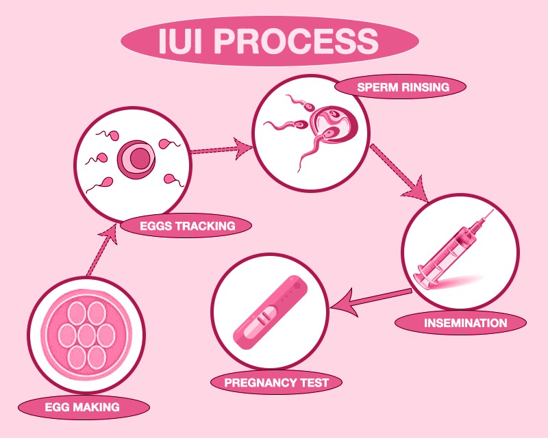 Ivf Cost In Ahmedabad Nisha Ivf Centre