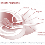 Sonohysterography