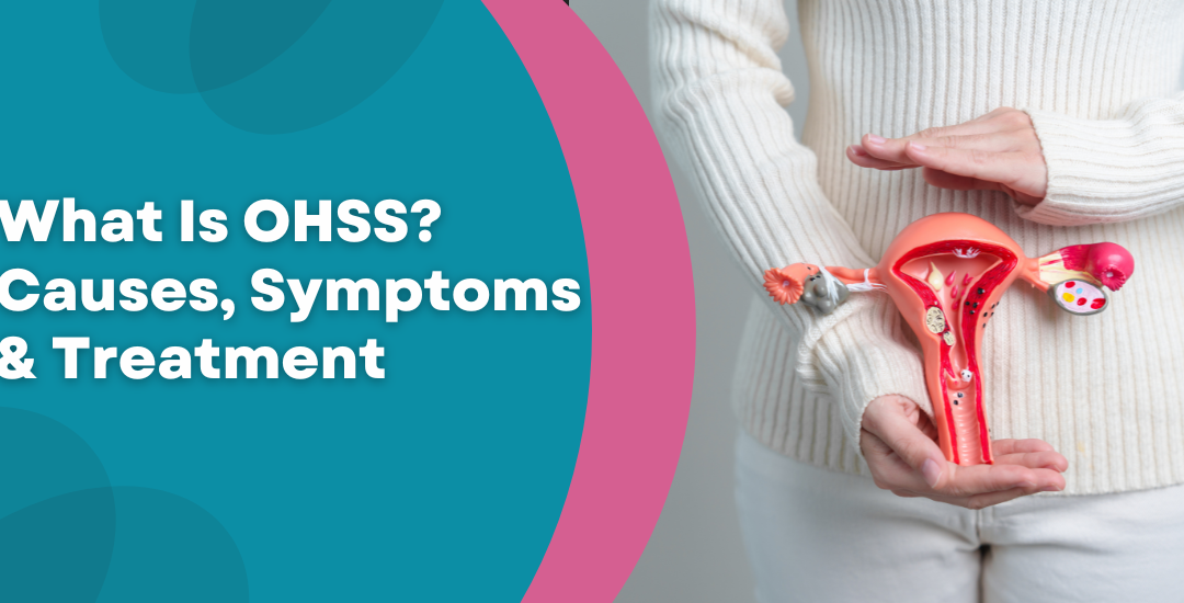 What Is OHSS Causes, Symptoms & Treatment