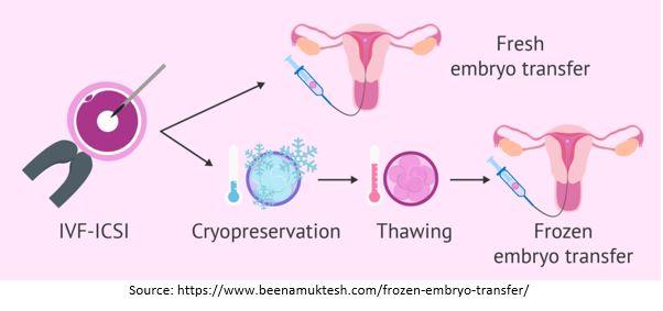 Frozen Embryo Transfer – FET
