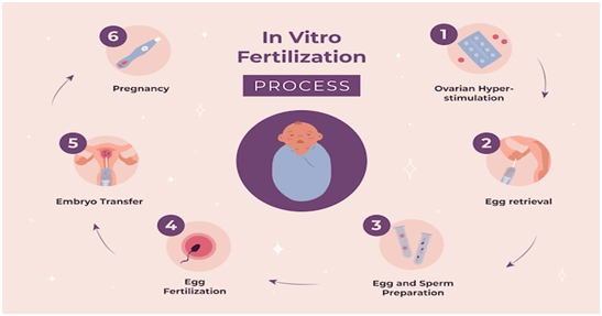 in-vitro-fertilization-treatment