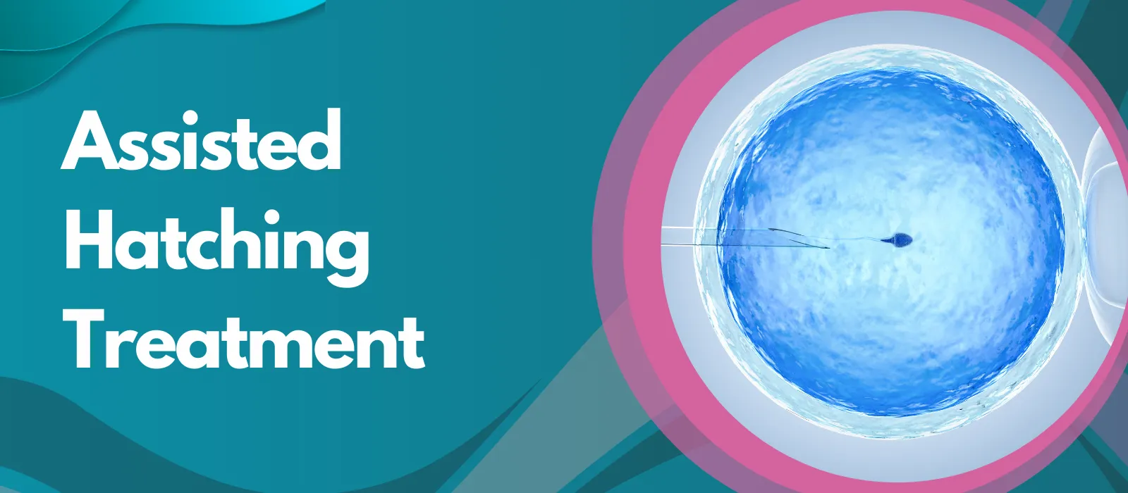 Assisted Hatching Treatment Assisted Hatching Treatment