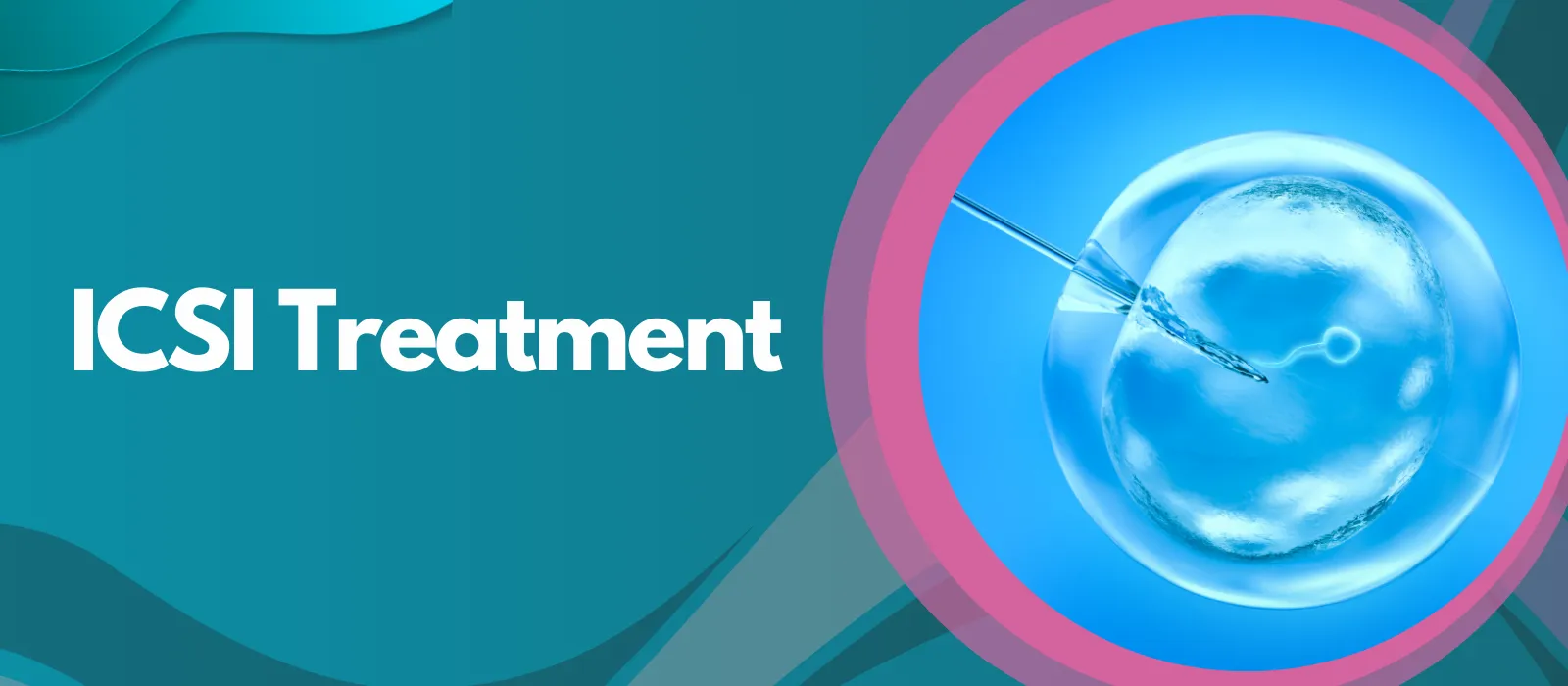 ICSI Treatment