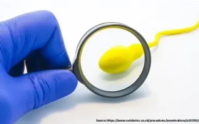 What is the Purpose of Semen Analysis in Male Infertility Treatment?