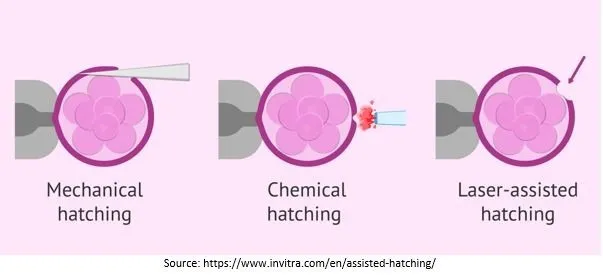 different-methods-of-Assisted-Hatching