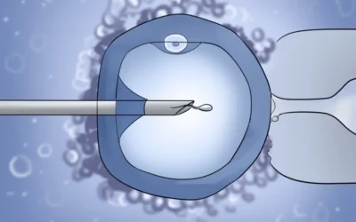 How can ICSI help in Infertility?