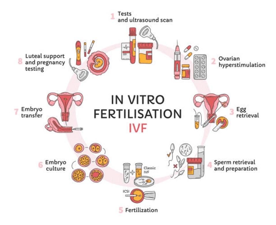 Exploring IVF