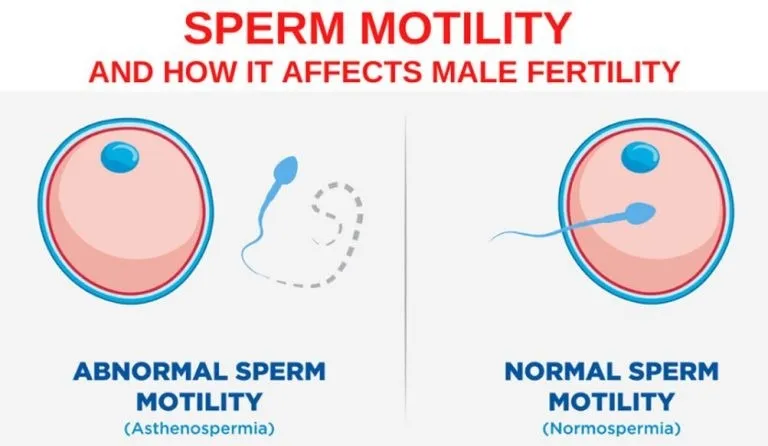 male-fertility-problems