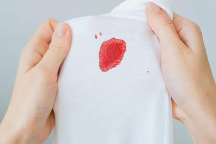 Common Causes of Spotting
