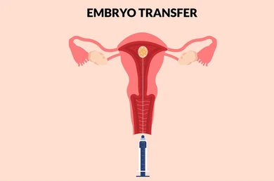 Embryo Transfer