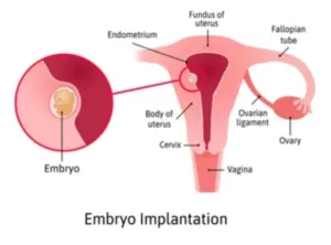 Timing of Implantation