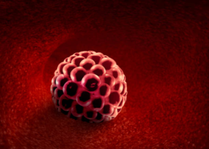  Causes of Cramping 5 Days After IUI