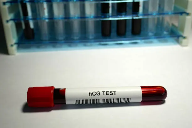 Will a pregnancy test 20 days post-IUI provide accurate results What is Portable Semen Analysis?