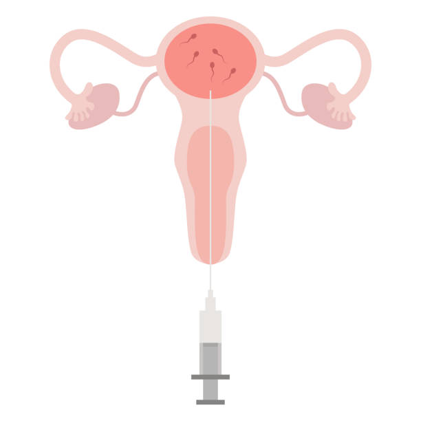 What is Portable Semen Analysis?