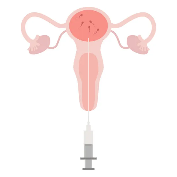 What is Portable Semen Analysis?