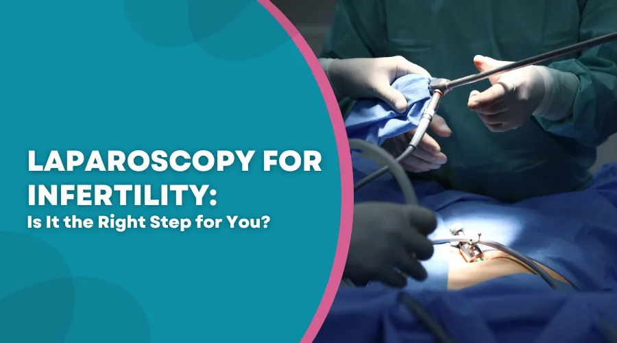 LAPAROSCOPY FOR INFERTILTY