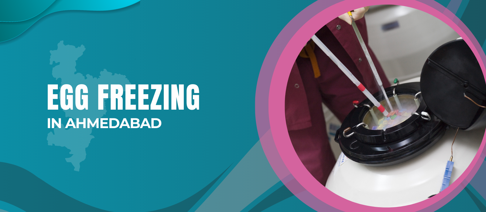 Egg Freezing in Ahmedabad