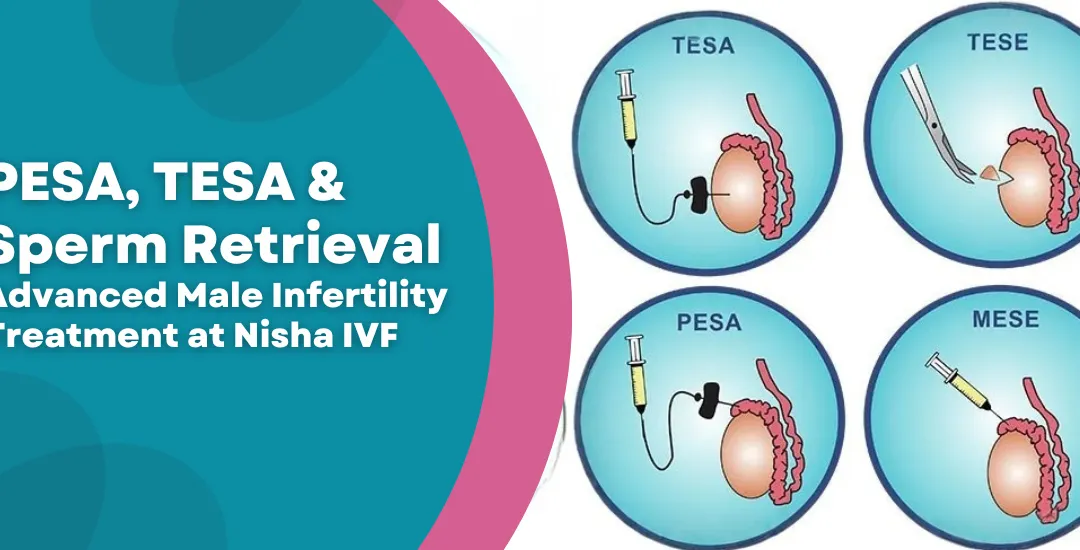 PESA_TESA__Sperm_Retrieval_Advanced_Male_Infertility_Treatment at Nisha IVF