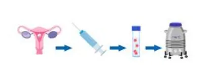 Male Infertility Treatment Cost