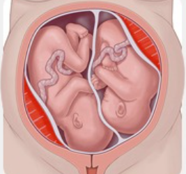 IVF and Twins: What Are the Chances? Myths vs Reality Explained