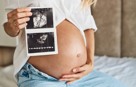 Pregnant woman holding ultrasound scans up to her bare belly, seated on a bed.