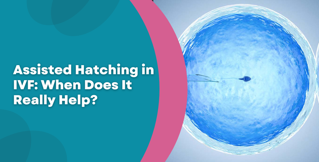 Assisted Hatching in IVF: When Does It Really Help?