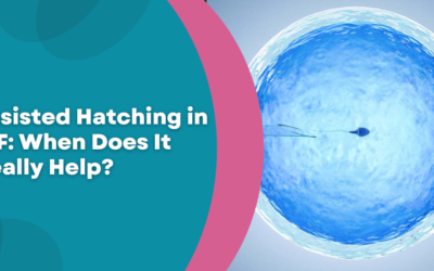 Assisted Hatching in IVF: When Does It Really Help?