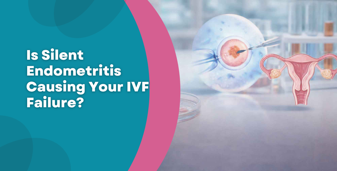 Is Silent Endometritis Causing Your IVF Failure