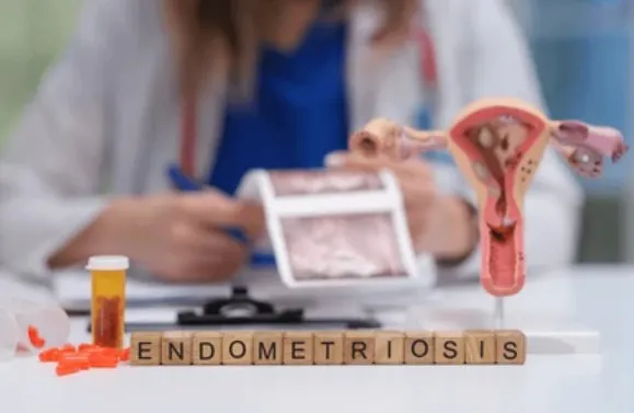 Endometriosis Treatment in Ahmedabad